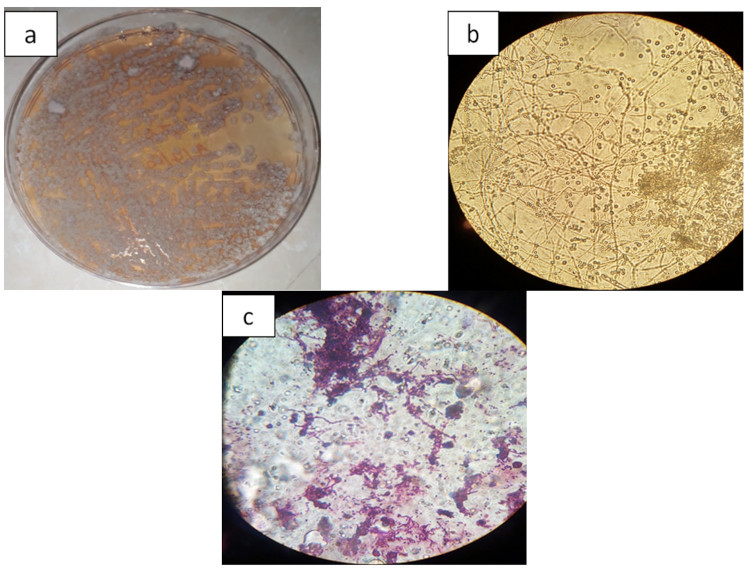 Image 10000000000002EE0000023E1790763A85DB47BA.jpg